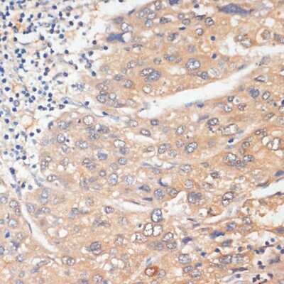 Immunohistochemistry-Paraffin: WNK3 Antibody - BSA Free [NBP2-94269]