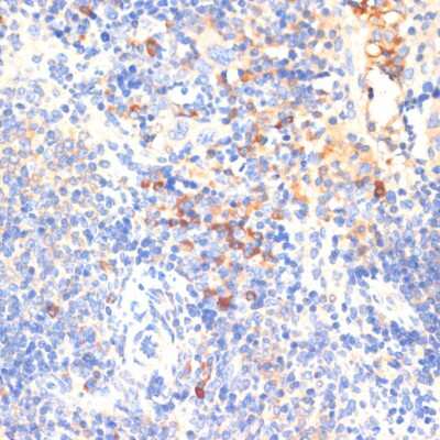Immunohistochemistry-Paraffin: WNK3 Antibody - BSA Free [NBP2-94269]