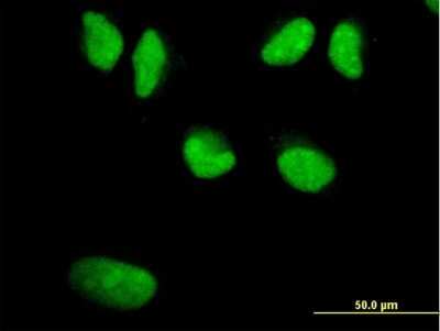 Immunocytochemistry/ Immunofluorescence: WRN Antibody (3C11) [H00007486-M09]