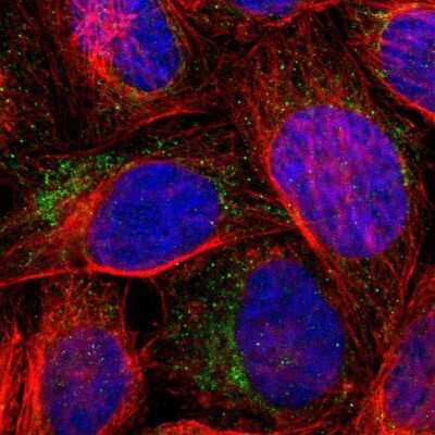 Immunocytochemistry/ Immunofluorescence: WSB1 Antibody [NBP1-84162]