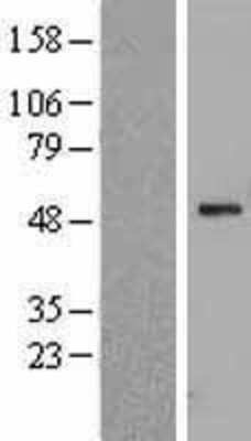 Western Blot: WSB1 Overexpression Lysate [NBL1-17883]
