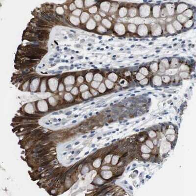Immunohistochemistry-Paraffin: WSCD1 Antibody [NBP1-81503]