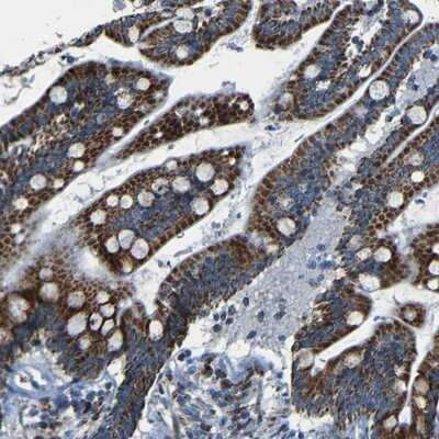Immunohistochemistry-Paraffin: WSCD2 Antibody [NBP1-93622]