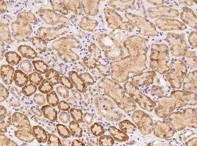 Immunohistochemistry-Paraffin: WSCD2 Antibody [NBP3-06011]