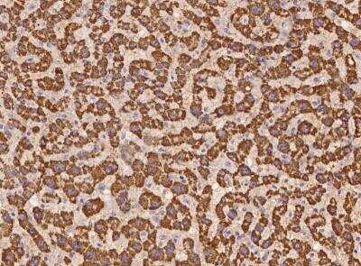 Immunohistochemistry-Paraffin: WSCD2 Antibody [NBP3-06011]