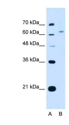 Western Blot: WSCD2 Antibody [NBP1-91299]
