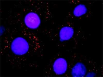 Proximity Ligation Assay: WSTF Antibody (5E9) [H00009031-M01]