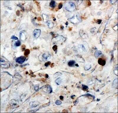 Immunohistochemistry: WT1 Antibody (6F-H2) - Azide and BSA Free [NBP2-81012]