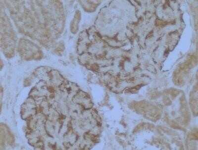 Immunohistochemistry: WT1 Antibody (6F-H2) - Azide and BSA Free [NBP2-81012]
