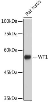 Western Blot: WT1 Antibody (6L9X6) [NBP3-16135]