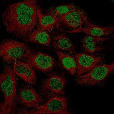 Immunocytochemistry/ Immunofluorescence: WT1 Antibody (CL13165) [NBP3-18564]