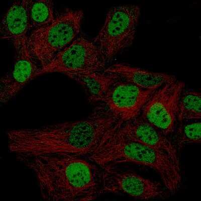 Immunocytochemistry/ Immunofluorescence: WT1 Antibody (CL13170) [NBP3-18547]