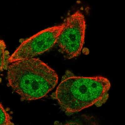 Immunocytochemistry/ Immunofluorescence: WT1 Antibody [NBP2-56086]