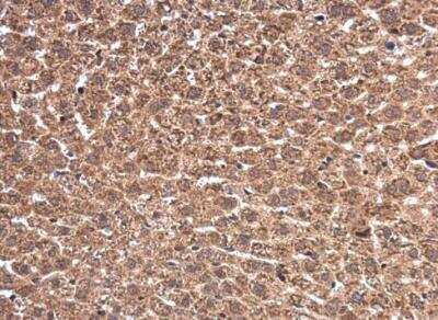 Immunohistochemistry-Paraffin: WT1 Antibody [NBP1-31314]