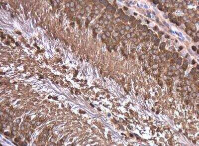 Immunohistochemistry-Paraffin: WT1 Antibody [NBP1-31314]