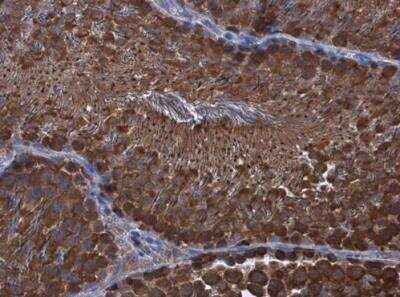 Immunohistochemistry-Paraffin: WT1 Antibody [NBP1-31314]