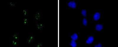 Immunocytochemistry/ Immunofluorescence: WT1 Antibody (SC06-41) [NBP2-67587]