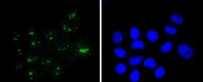 Immunocytochemistry/ Immunofluorescence: WT1 Antibody (SC06-41) [NBP2-67587]