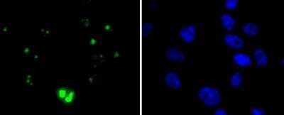 Immunocytochemistry/ Immunofluorescence: WT1 Antibody (SC06-41) [NBP2-67587]