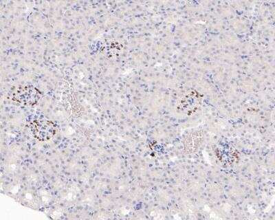 Immunohistochemistry-Paraffin: WT1 Antibody (SC06-41) [NBP2-67587]
