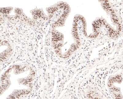 Immunohistochemistry-Paraffin: WT1 Antibody (SC06-41) [NBP2-67587]