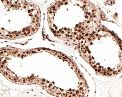 Immunohistochemistry-Paraffin: WT1 Antibody (SC06-41) [NBP2-67587]