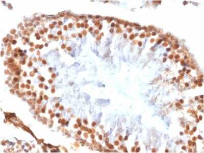 Immunohistochemistry-Paraffin: WT1 Antibody (WT1/1434R) [NBP2-53182]