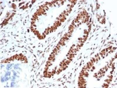 Immunohistochemistry-Paraffin: WT1 Antibody (WT1/3477R) - Azide and BSA Free [NBP3-08966]