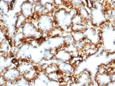 Immunohistochemistry-Paraffin: WT1 Antibody (WT1/3477R) - Azide and BSA Free [NBP3-08966]