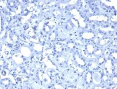 Immunohistochemistry-Paraffin: WT1 Antibody (WT1/3477R) [NBP3-07221]