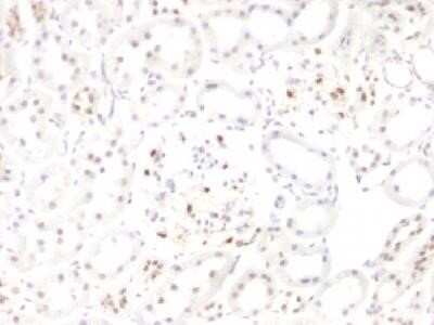 Immunohistochemistry-Paraffin: WT1 Antibody (WT1/857 + 6F-H2) - Azide and BSA Free [NBP2-47858]