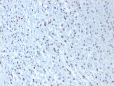 Immunohistochemistry-Paraffin: WT1 Antibody (WT1/857 + 6F-H2) - Azide and BSA Free [NBP2-47858]