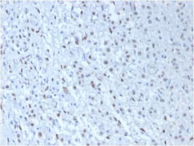Immunohistochemistry-Paraffin: WT1 Antibody (WT1/857 + 6F-H2) [NBP2-44607]