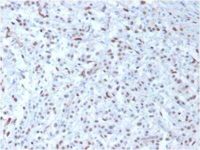 Immunohistochemistry-Paraffin: WT1 Antibody (WT1/857) - IHC-Prediluted [NBP2-48216]