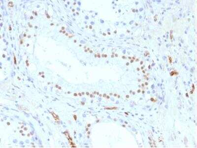 Immunohistochemistry-Paraffin: WT1 Antibody (WT1/857) - IHC-Prediluted [NBP2-48216]