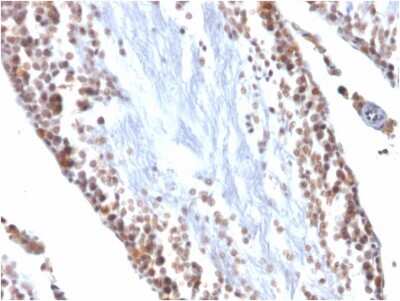 Immunohistochemistry-Paraffin: WT1 Antibody (WT1/857) [NBP2-44606]