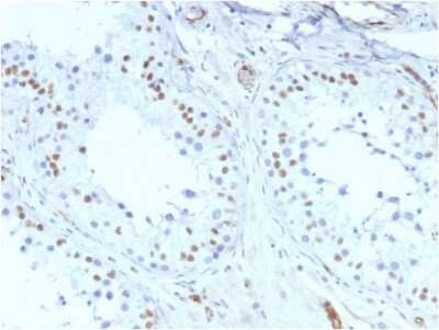 Immunohistochemistry-Paraffin: WT1 Antibody (rWT1/857) [NBP2-53181]