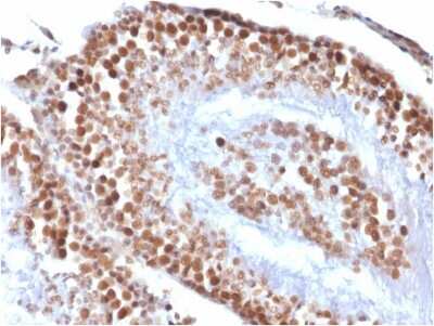 Immunohistochemistry-Paraffin: WT1 Antibody (rWT1/857) [NBP2-53181]