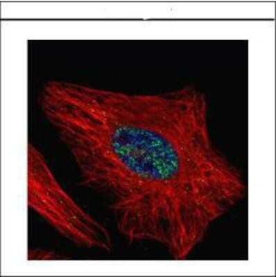 Immunocytochemistry/ Immunofluorescence: WTAP Antibody [NBP1-31777]