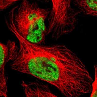 Immunocytochemistry/ Immunofluorescence: WTAP Antibody [NBP1-83040]