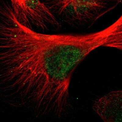 Immunocytochemistry/ Immunofluorescence: WTAP Antibody [NBP1-83041]