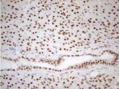 Immunohistochemistry: WTAP Antibody (OTI12G7) - Azide and BSA Free [NBP2-74870]
