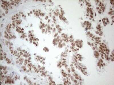 Immunohistochemistry: WTAP Antibody (OTI12G7) - Azide and BSA Free [NBP2-74870]