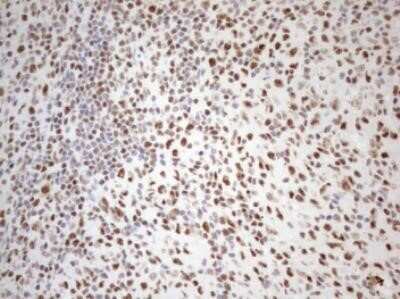 Immunohistochemistry: WTAP Antibody (OTI12G7) - Azide and BSA Free [NBP2-74870]