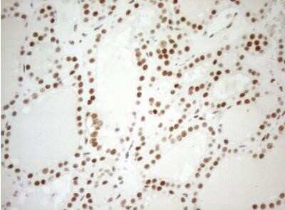 Immunohistochemistry: WTAP Antibody (OTI12G7) - Azide and BSA Free [NBP2-74870]