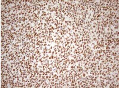Immunohistochemistry-Paraffin: WTAP Antibody (OTI12G7) [NBP2-46368]