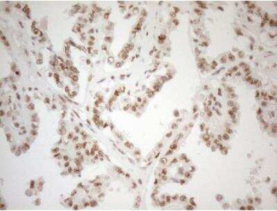 Immunohistochemistry-Paraffin: WTAP Antibody (OTI12G7) [NBP2-46368]