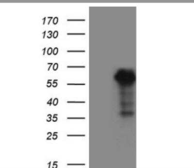 Western Blot: WTAP Antibody (OTI12G7) [NBP2-46368]