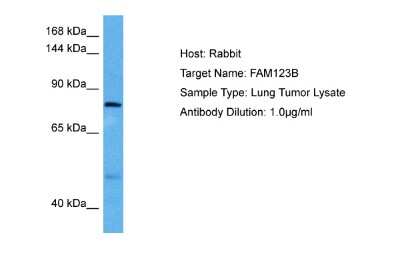 Western Blot: WTX Antibody [NBP2-88594]