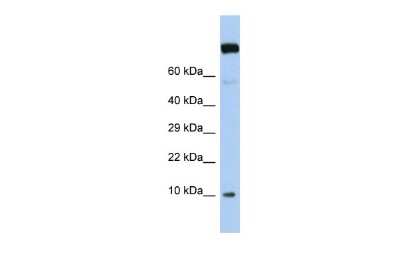 Western Blot: WW domain binding protein 5 Antibody [NBP2-83764]